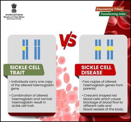 sickle cell trait vs sickle cell
